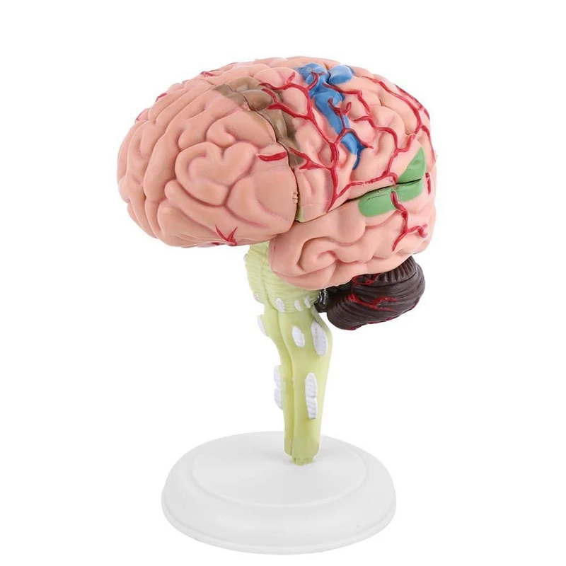 Разобранная Модел На Човешкия Мозък Структурна Анатомия На Aicc Модул За Обучение Инструмент
